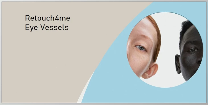 Download Retouch4me Eye Vessels v1.010