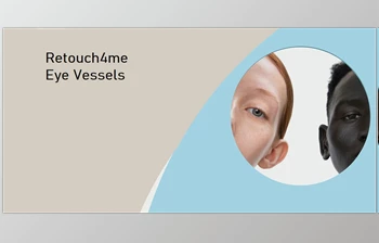 Download Retouch4me <span class='badge badge-warning'>Eye</span> Vessels v1.010